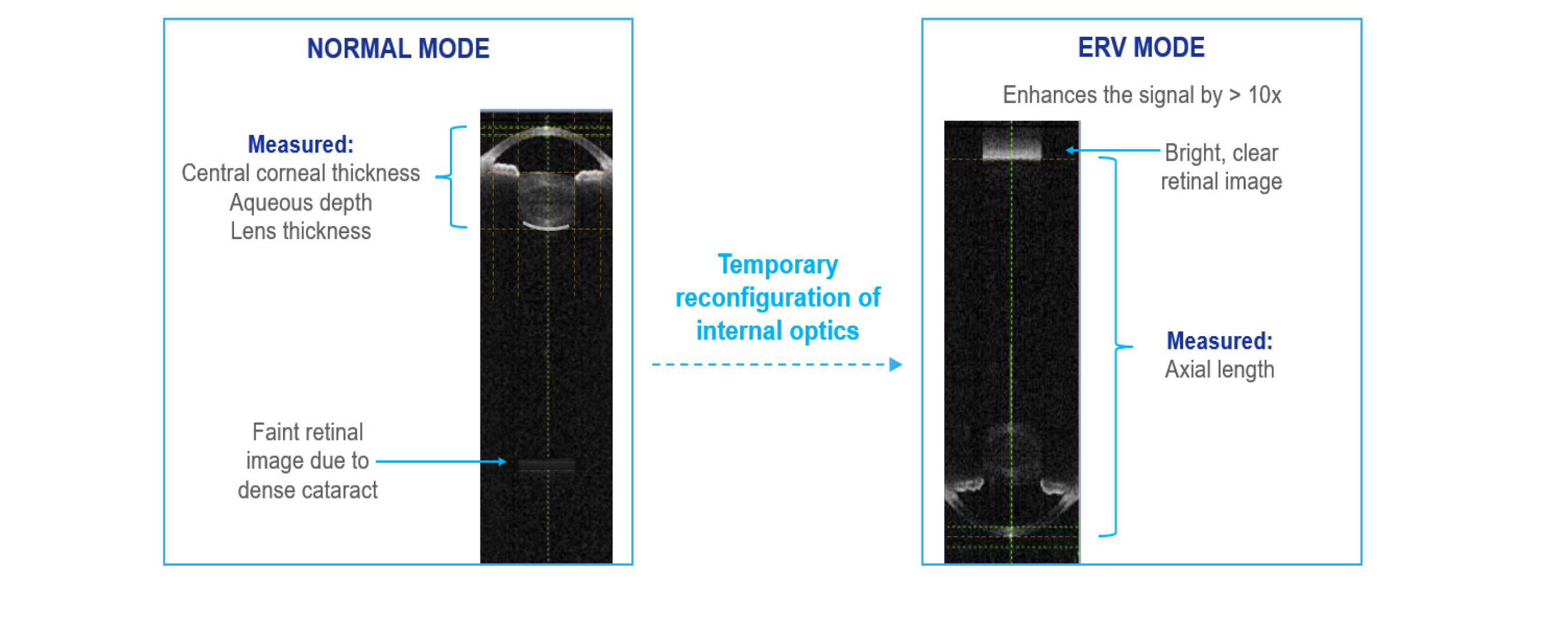 A comparison of biometry images captured by the ARGOS Biometer in